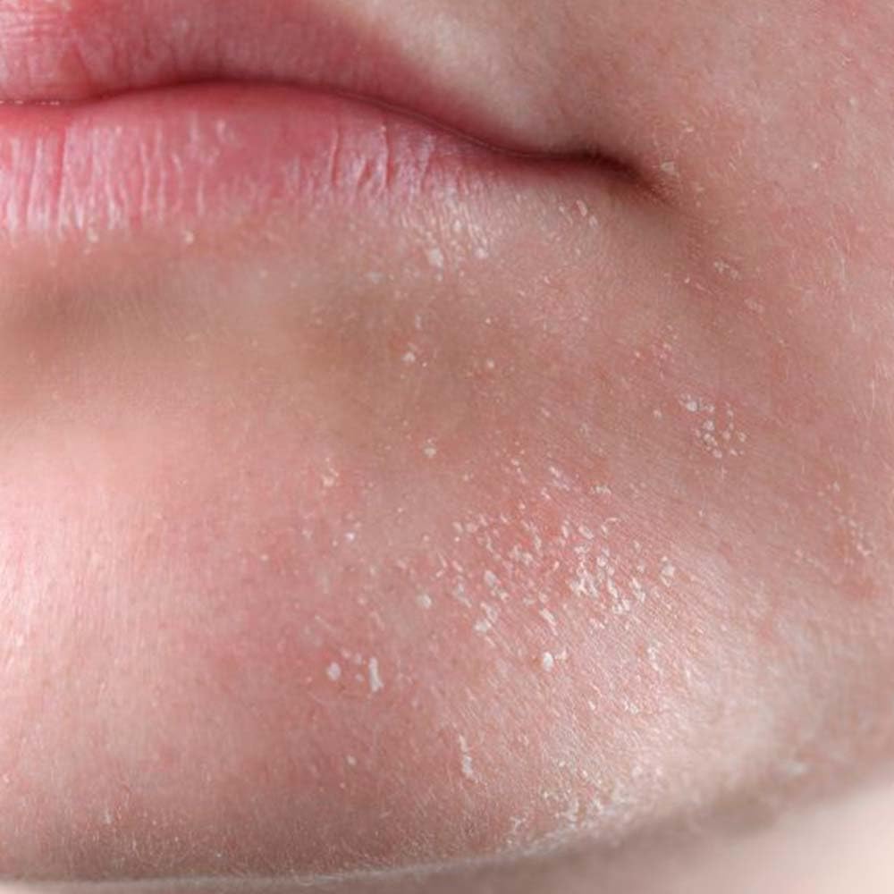 Jabón Natural De Manteca De Coco (90g) - Para Piel Seca Y Agrietada - Calma La Piel Con Psoriasis, Dermatitis O Eccemas_3
