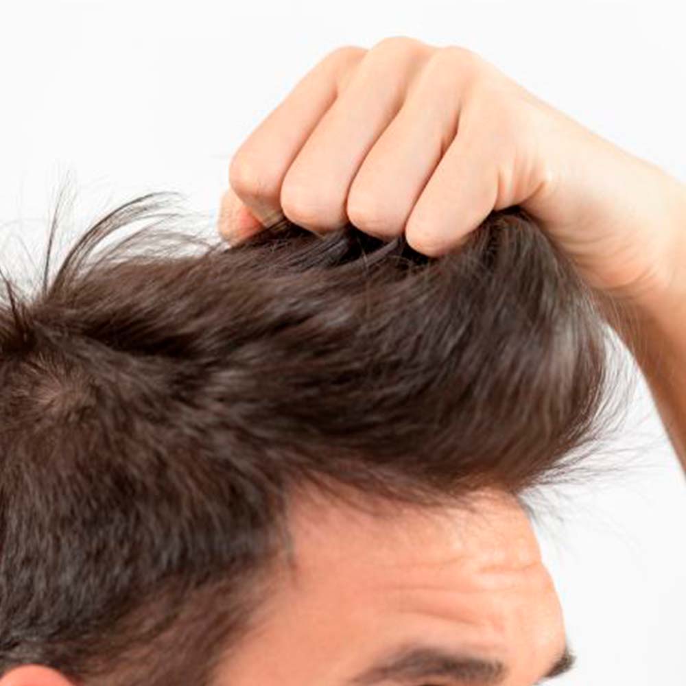 Pack 4 Champú Sólido Anticaída y Fortalecedor - 100% Natural - Todo Tipo de Cabello - Con Aceite de Ricino_2