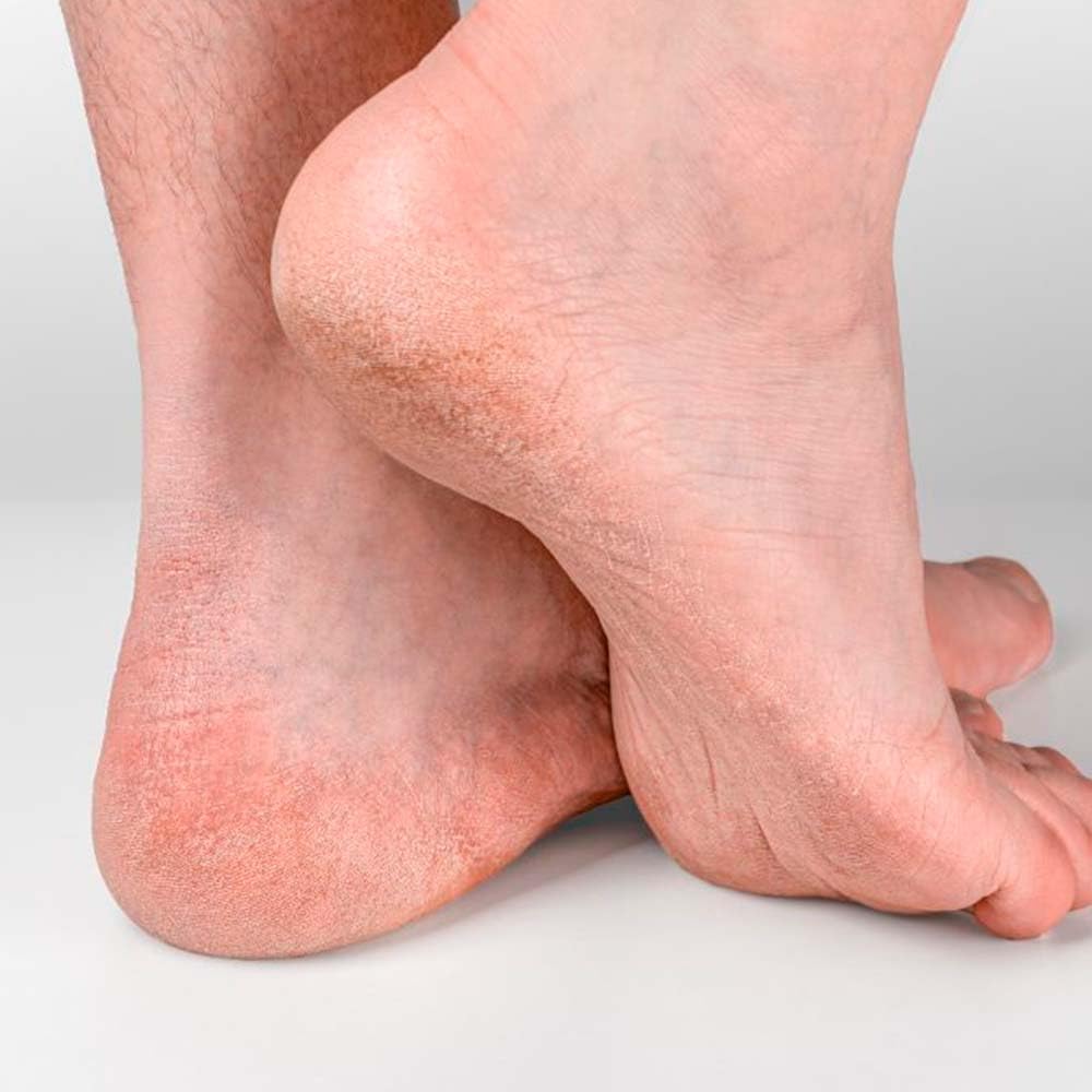Jabón Natural Exfoliante Piedra Pómez 90g - Reduce Durezas En Talones, Rodillas, Manos Y Codos - Exfolia Y Nutre La Piel_3