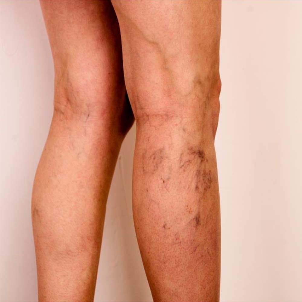 Pack 2 Jabón Natural Algas Marinas - Activa Circulación En Piernas Cansadas - Exfoliante Y Anticelulítico - Para Cuerpo_5