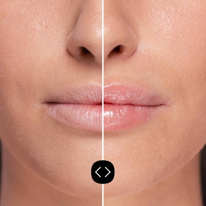 Pack 2x Voluminizador Labial Hialurónico Freshly 5ml