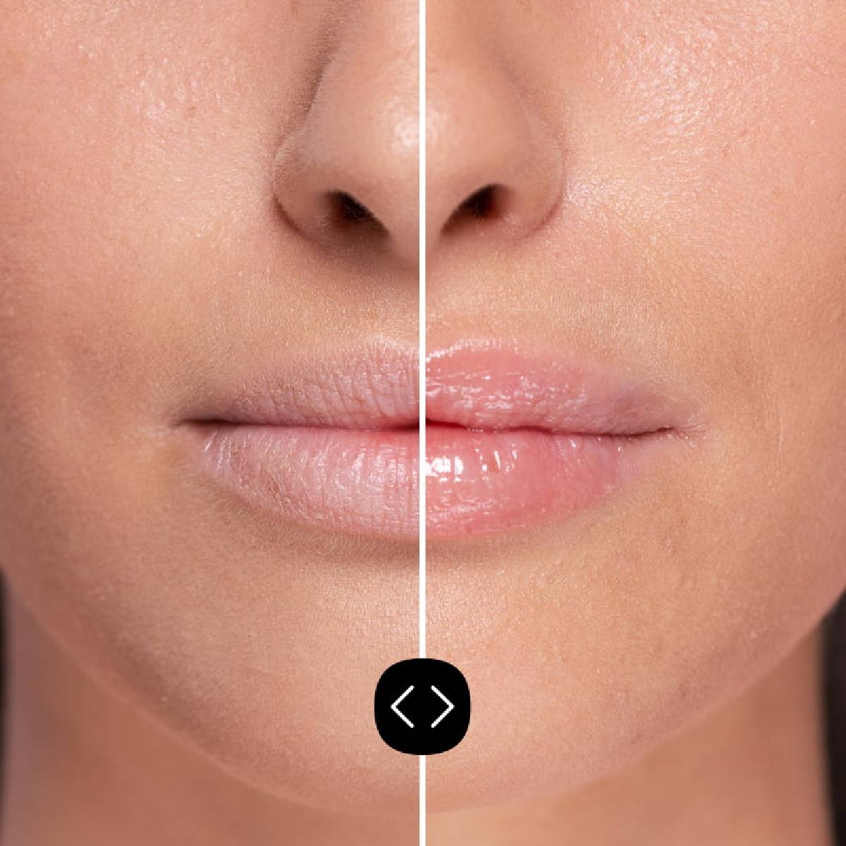 Voluminizador Labial Hialurónico Freshly 5ml